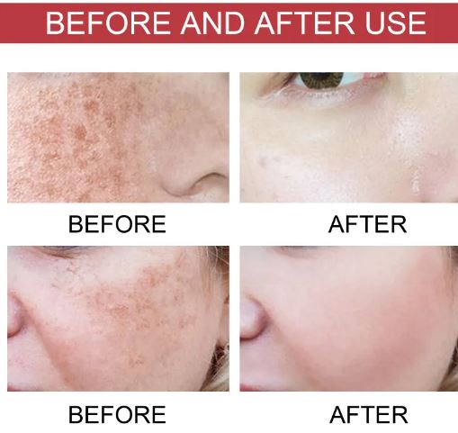 Niacinamide Moisturizing Care Solution