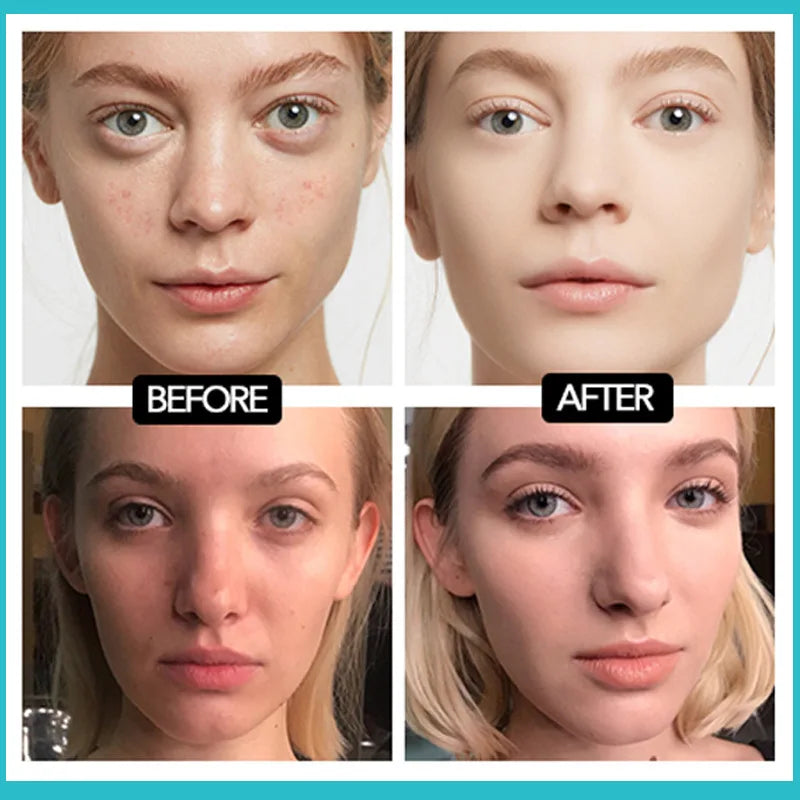 Matte Foundation 30ml Concealer Acne Mark Isolation Pump Free Liquid Foundation Cover Black Eye Circles Even Out Skin Tone